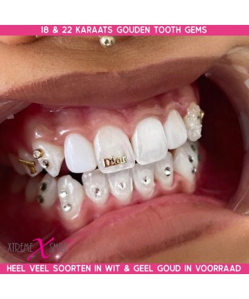 Gouden Tooth gem Dior logo - 18 kt tandsieraad in geel goud