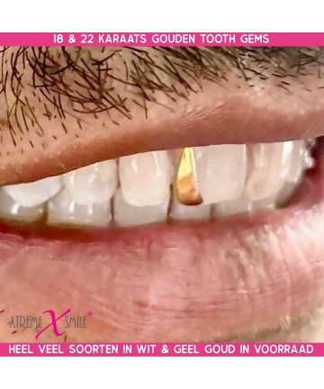 Weißgold Zahnschmuck Schlitz 18kt 5,75mm