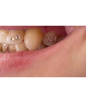 (White) Gold Tooth Gem 18ct - Bitch - Worldwide shipping