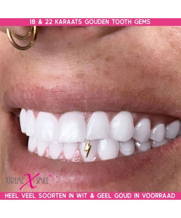 Wit Gouden Bliksem Flits Tandsieraad - op vooraad Bij X-treme Smile