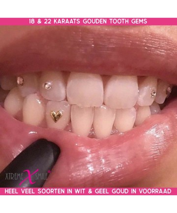 Goldschmuck Herz 18kt - Zahnschmuck Weissgold kaufen?