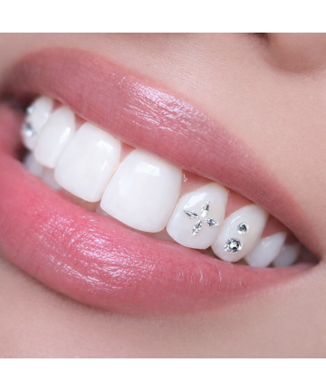 Micro Tandkristallen Ruit – 1 Stuk Micro Tooth Gems (4 Kleuren) op voorraad