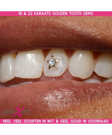 Gouden Tandsieraad 22kt - ster of sterretje met diamant 0.01kt - bij ons op voorraad!
